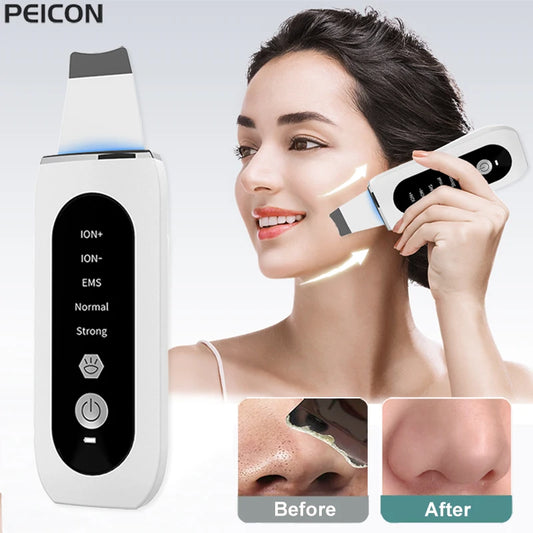 Ultrasonic Skin Scrubber